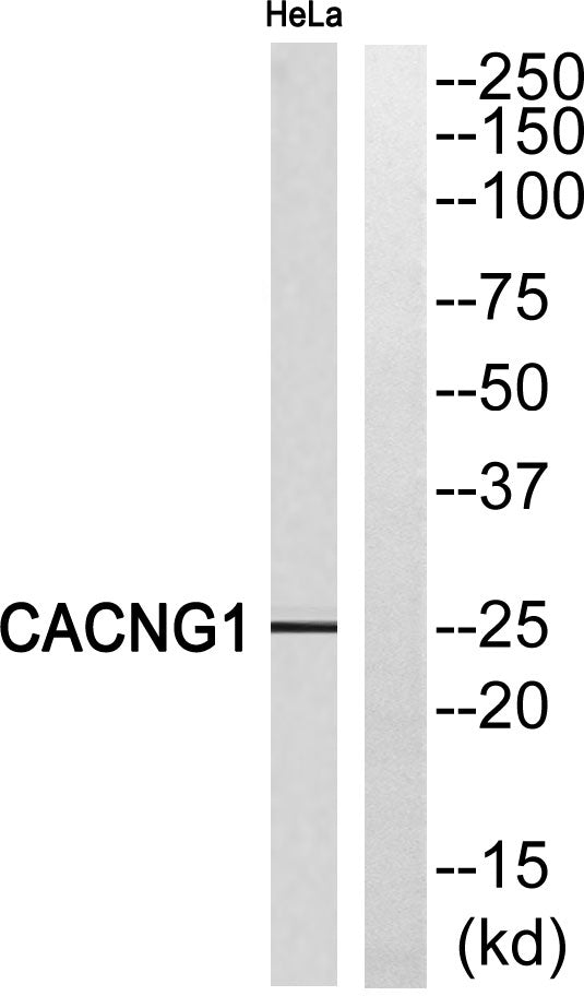 L-type Ca++ CP γ1 Rabbit Polyclonal Antibody