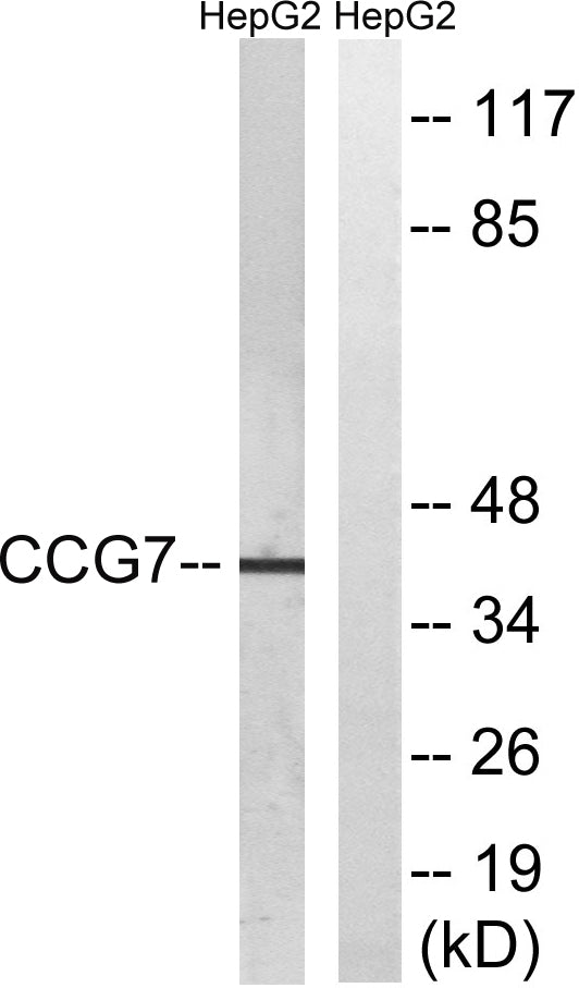 L-type Ca++ CP γ7 Rabbit Polyclonal Antibody