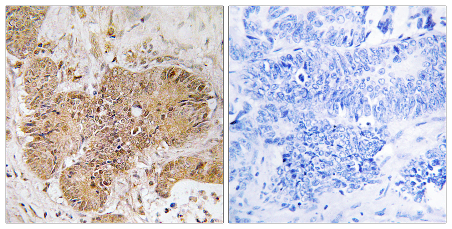 LUC7L2 Rabbit Polyclonal Antibody