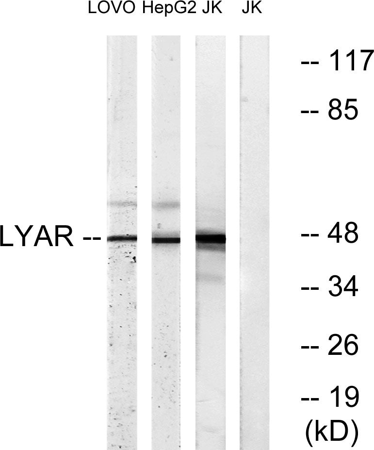 LYAR Rabbit Polyclonal Antibody