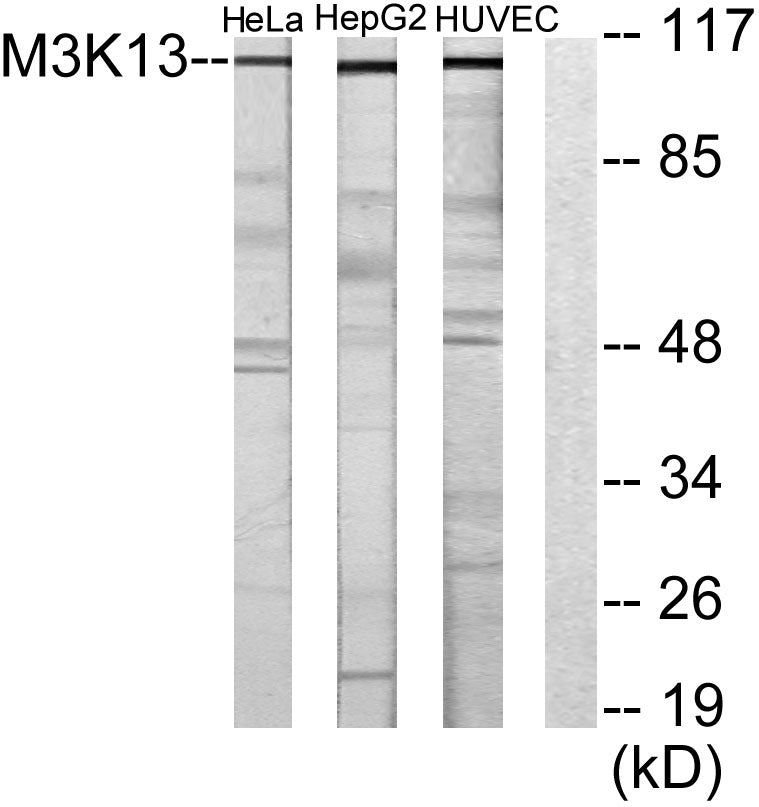 LZK Rabbit Polyclonal Antibody