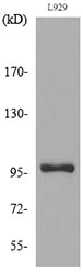 MACC1 Rabbit Polyclonal Antibody