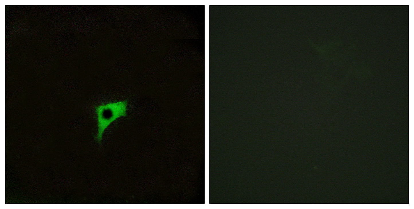 mAChR M2 Rabbit Polyclonal Antibody
