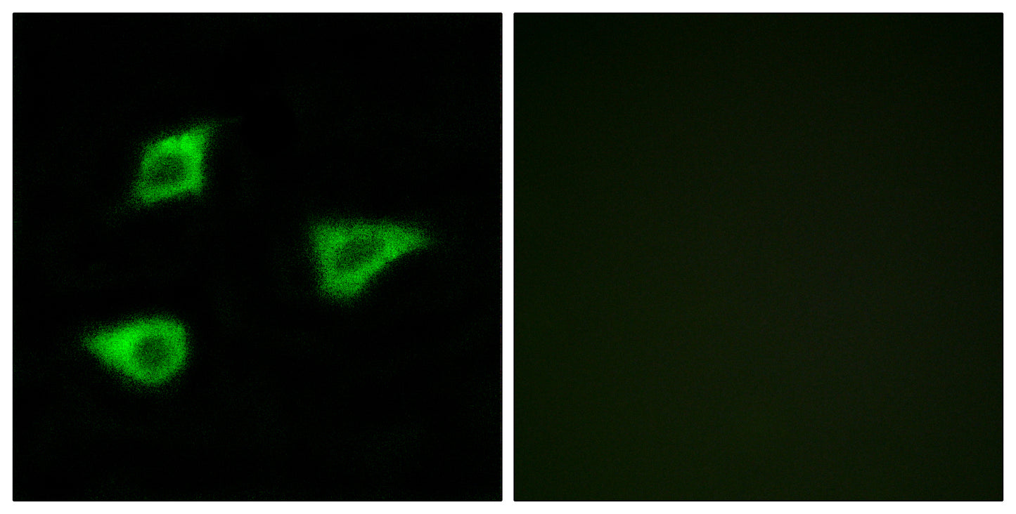 mAChR M4 Rabbit Polyclonal Antibody
