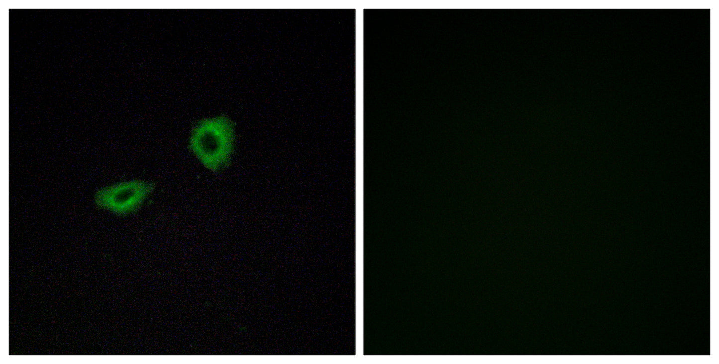 mAChR M5 Rabbit Polyclonal Antibody