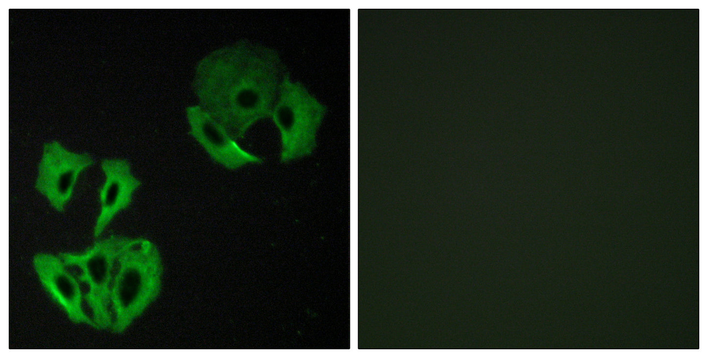 MADD Rabbit Polyclonal Antibody