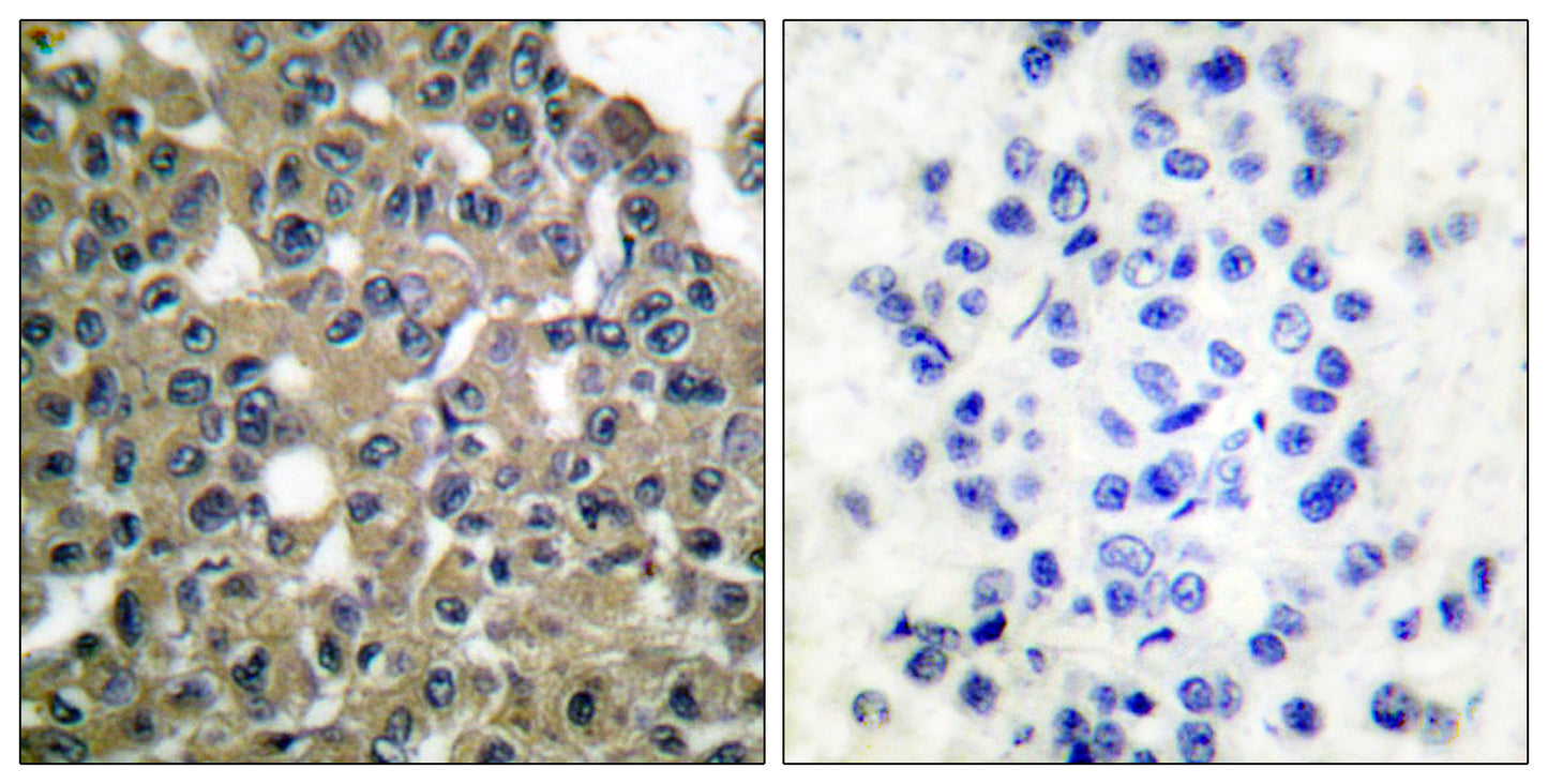 MAGE-1 Rabbit Polyclonal Antibody