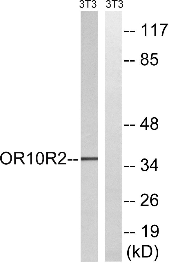 MAGE-A5 Rabbit Polyclonal Antibody
