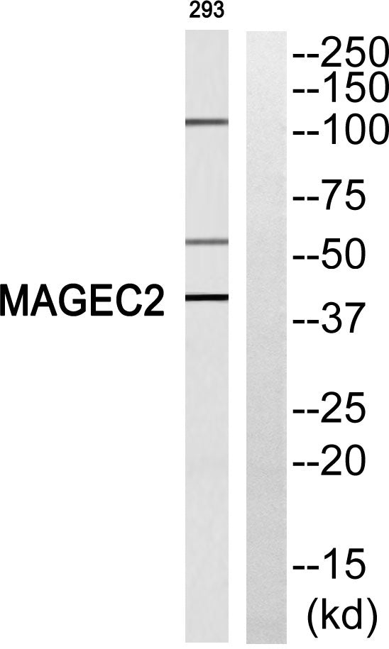 MAGE-C2 Rabbit Polyclonal Antibody