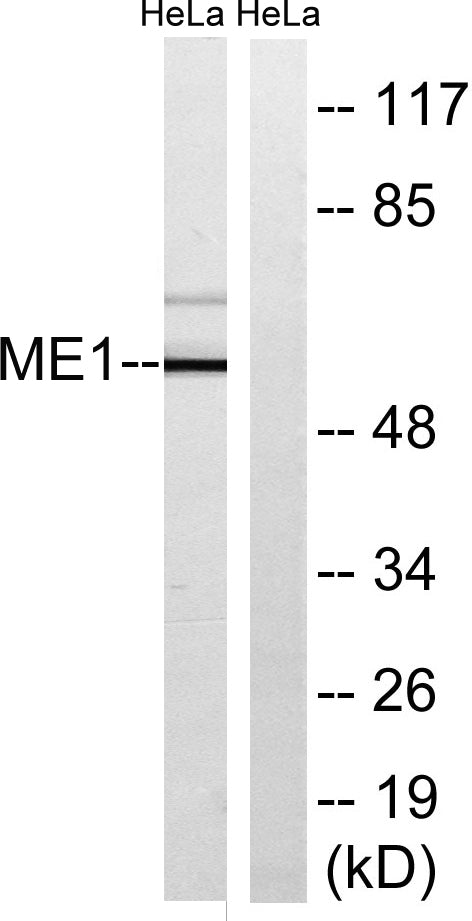 Malic enzyme 1 Rabbit Polyclonal Antibody