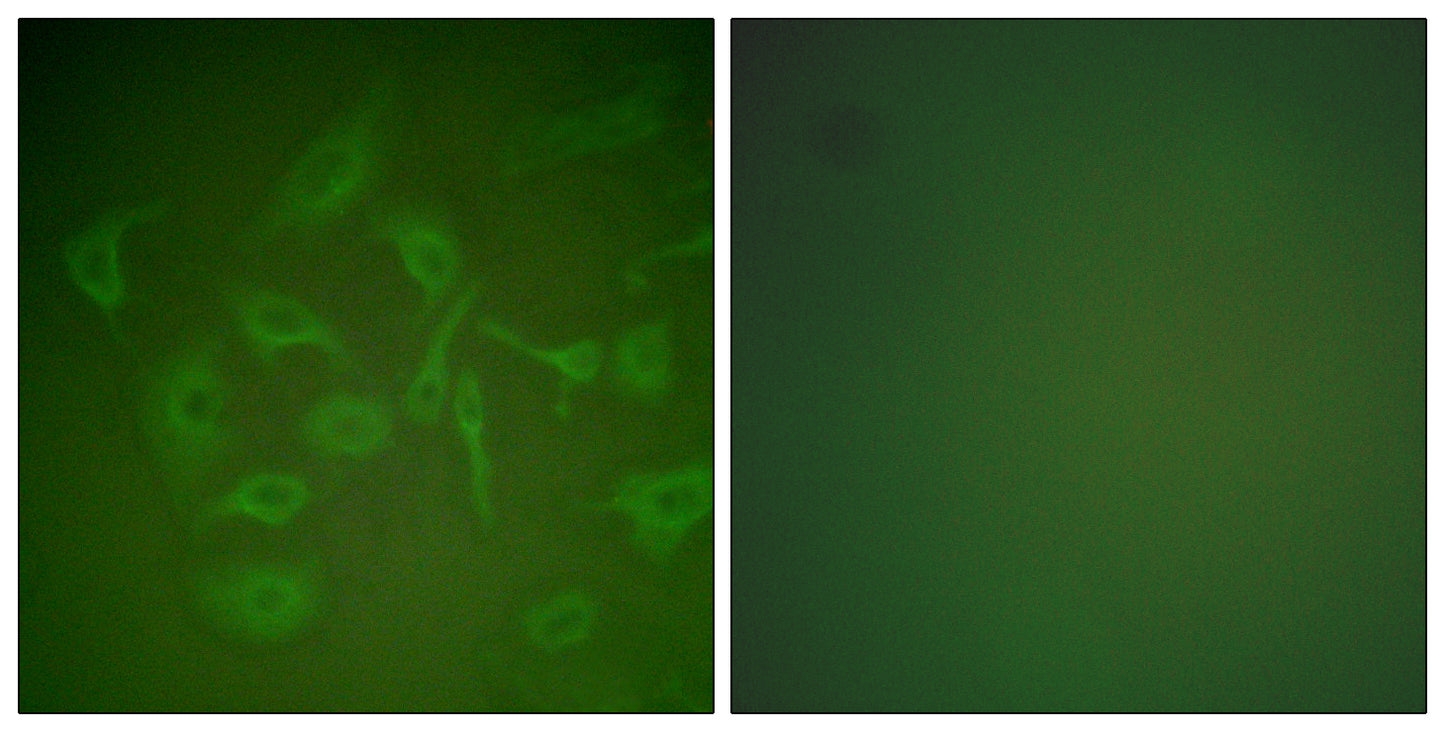 Mammaglobin A Rabbit Polyclonal Antibody