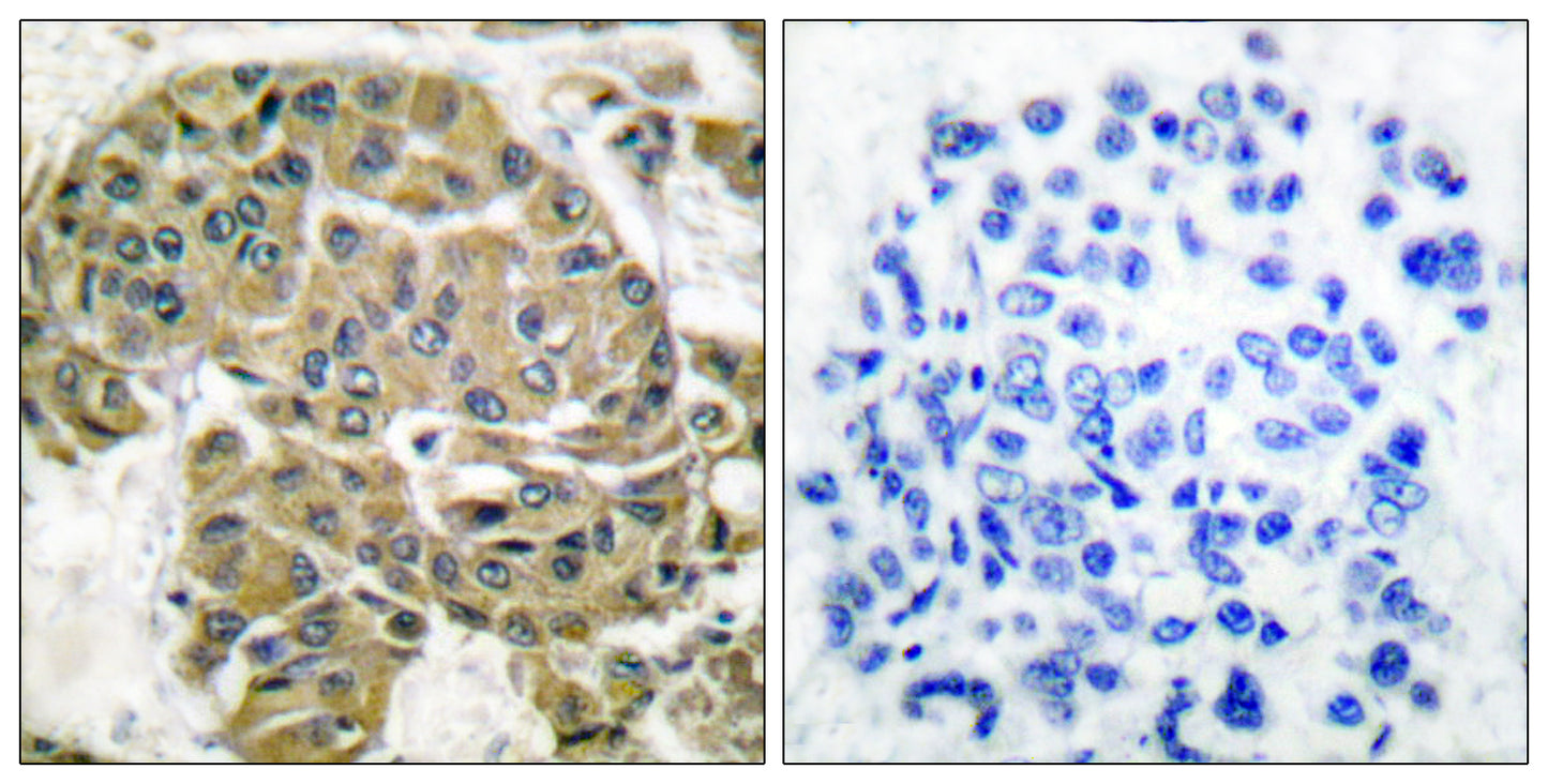 Mammaglobin B Rabbit Polyclonal Antibody