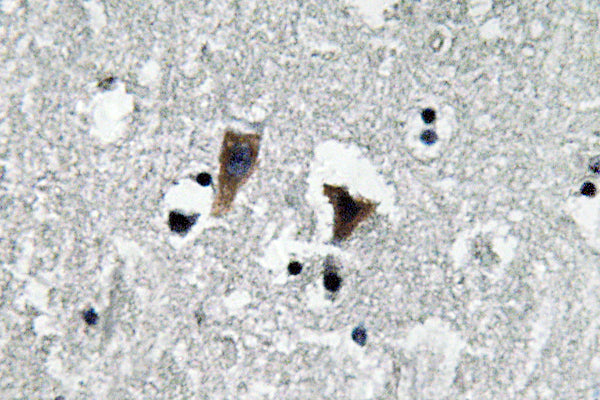 MAO-A Rabbit Polyclonal Antibody