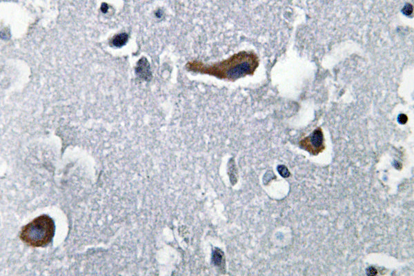 MAP-2 Rabbit Polyclonal Antibody