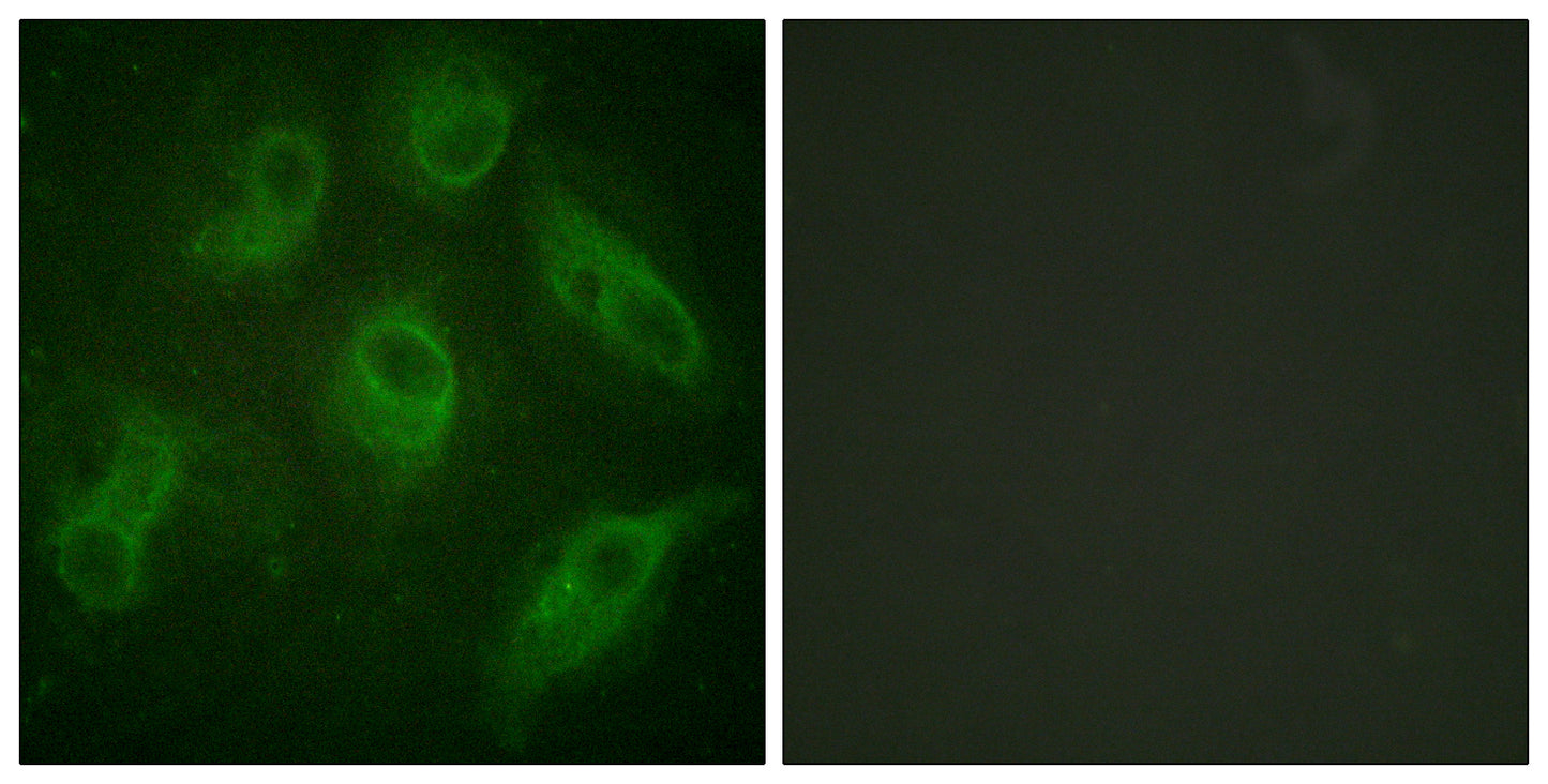 MAP-4 Rabbit Polyclonal Antibody