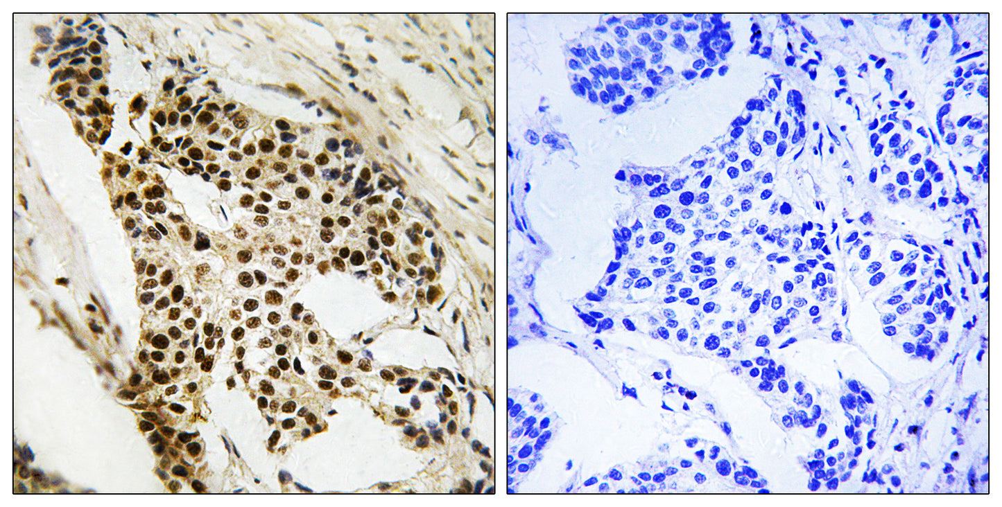 MAPKAPK-2 Rabbit Polyclonal Antibody