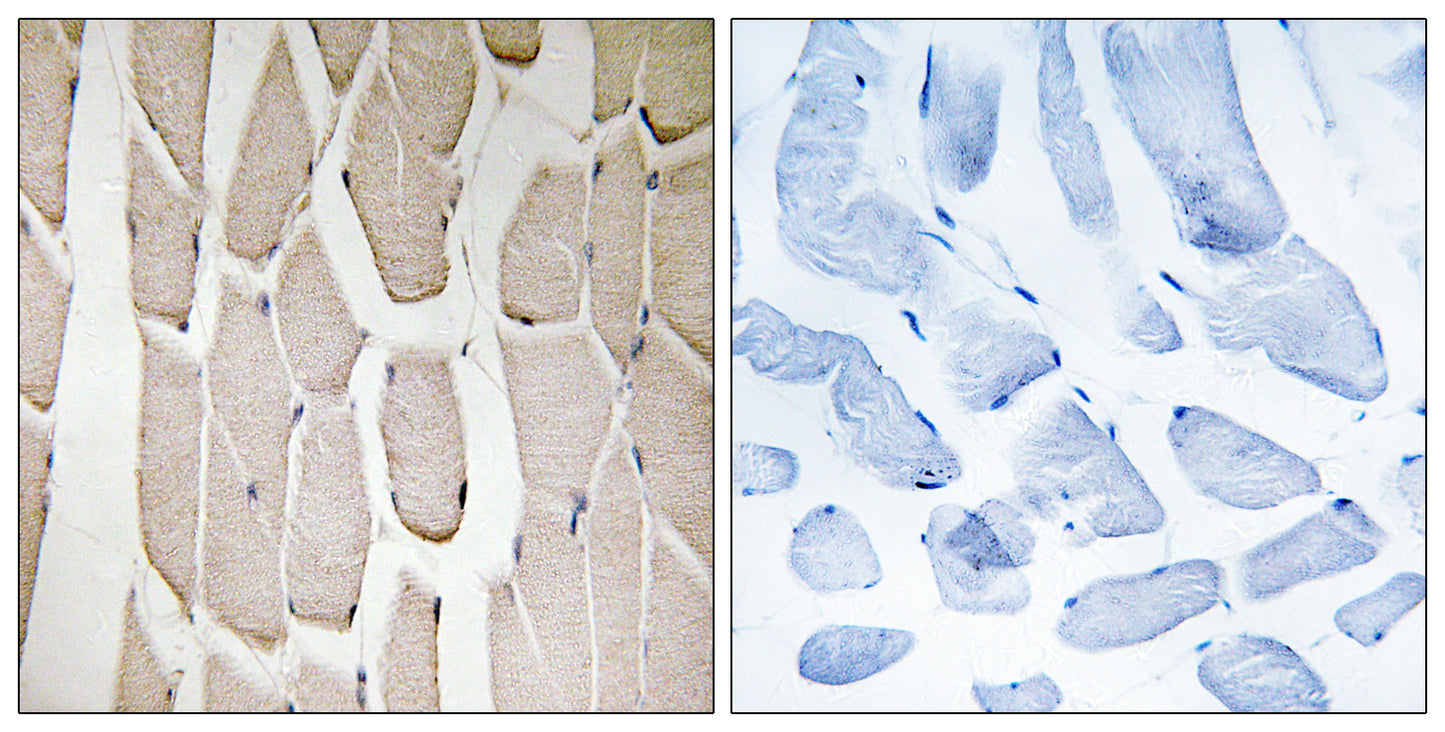 MARCH3 Rabbit Polyclonal Antibody