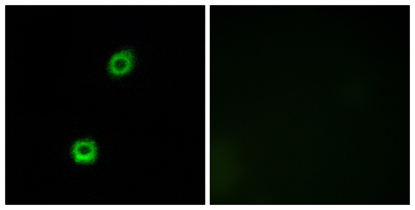 MARCKS Rabbit Polyclonal Antibody