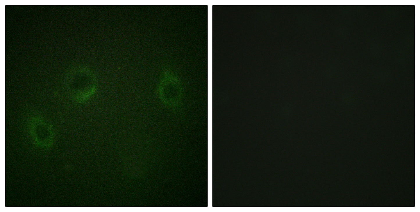 MARK1/2/3/4 Rabbit Polyclonal Antibody