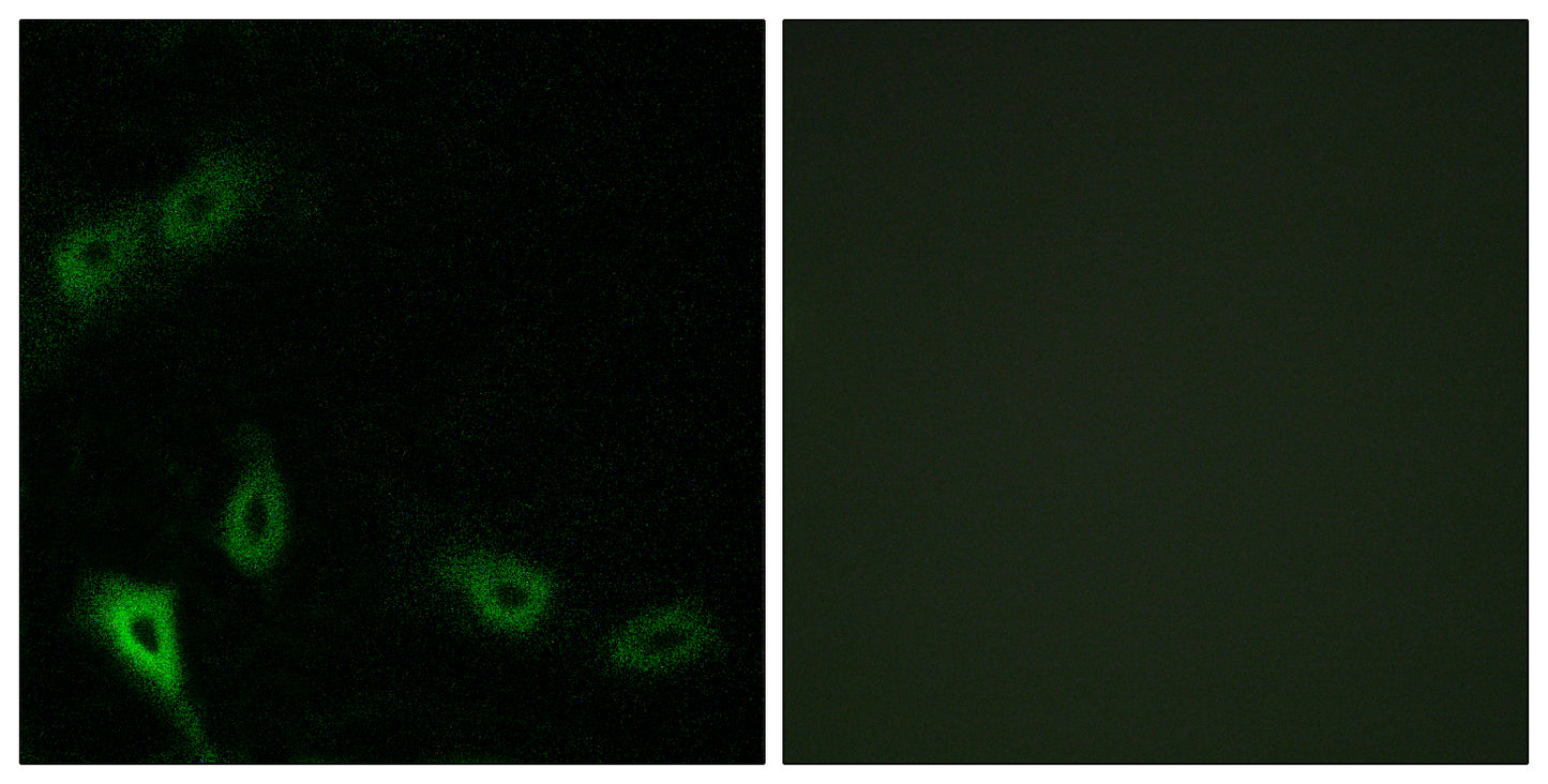 MARK2 Rabbit Polyclonal Antibody