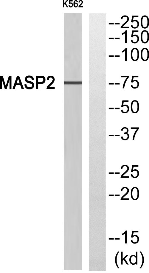 MASP-2 Rabbit Polyclonal Antibody