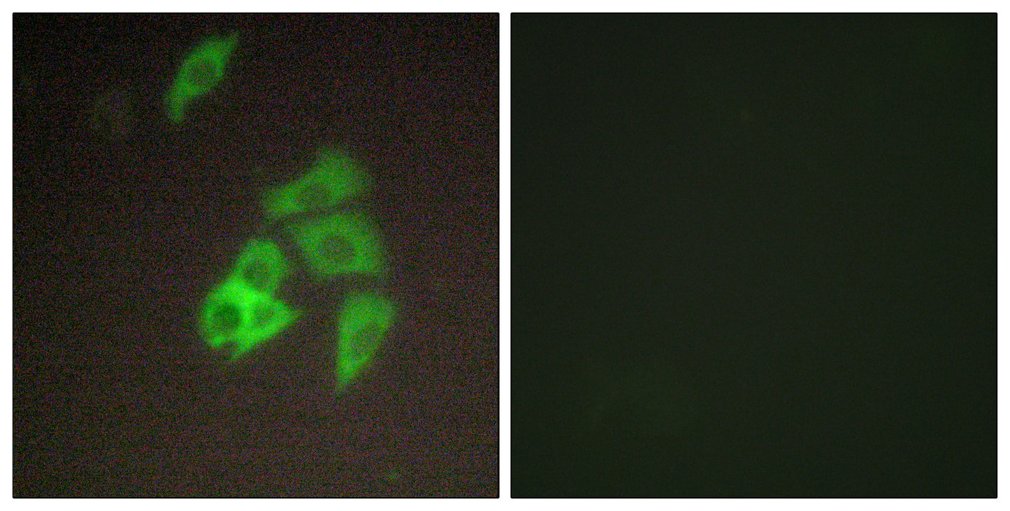 Matriptase Rabbit Polyclonal Antibody