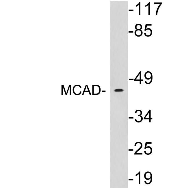 MCAD Rabbit Polyclonal Antibody