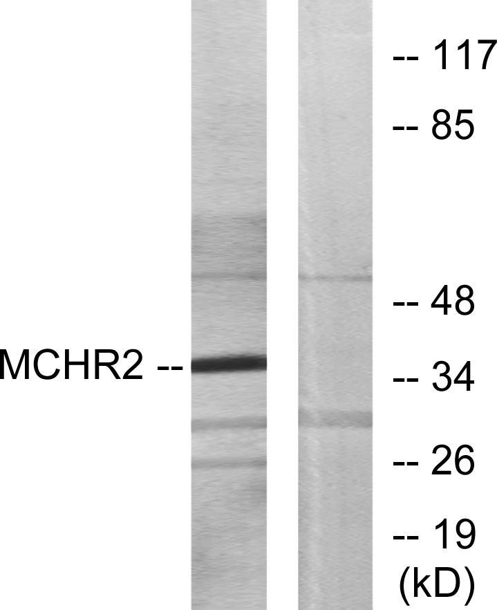 MCH-2R Rabbit Polyclonal Antibody