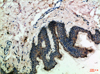 MCP-3 Rabbit Polyclonal Antibody