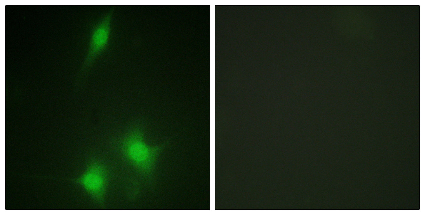 MDM2 Rabbit Polyclonal Antibody