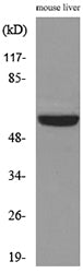 MDM2 Rabbit Polyclonal Antibody