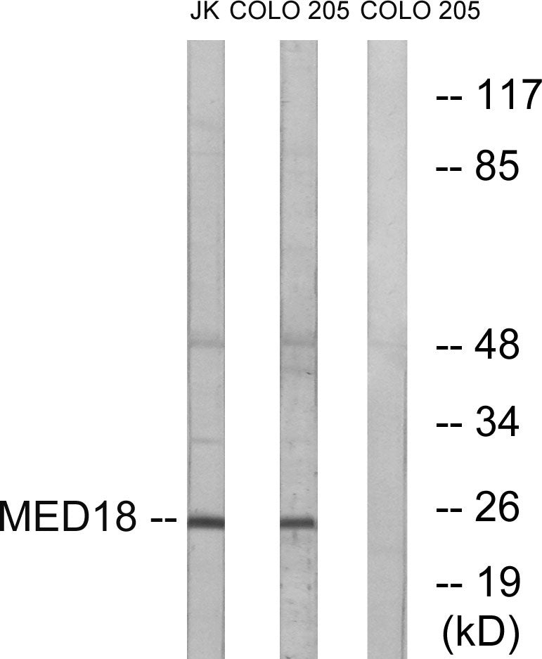 Med18 Rabbit Polyclonal Antibody