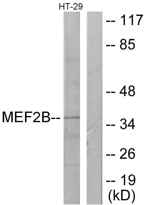 MEF-2B Rabbit Polyclonal Antibody