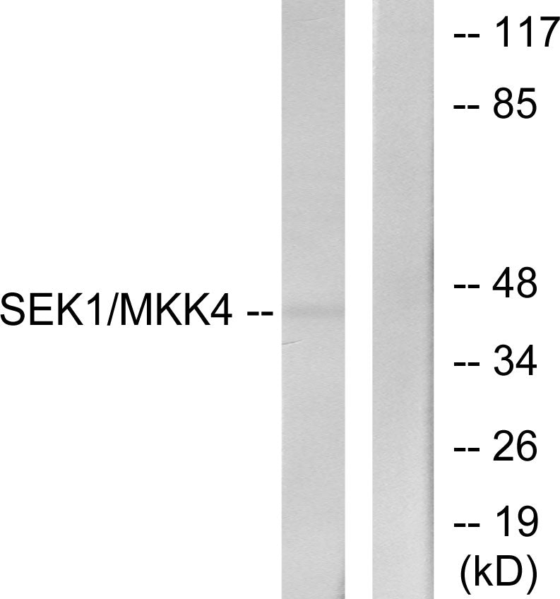 MEK-4 Rabbit Polyclonal Antibody