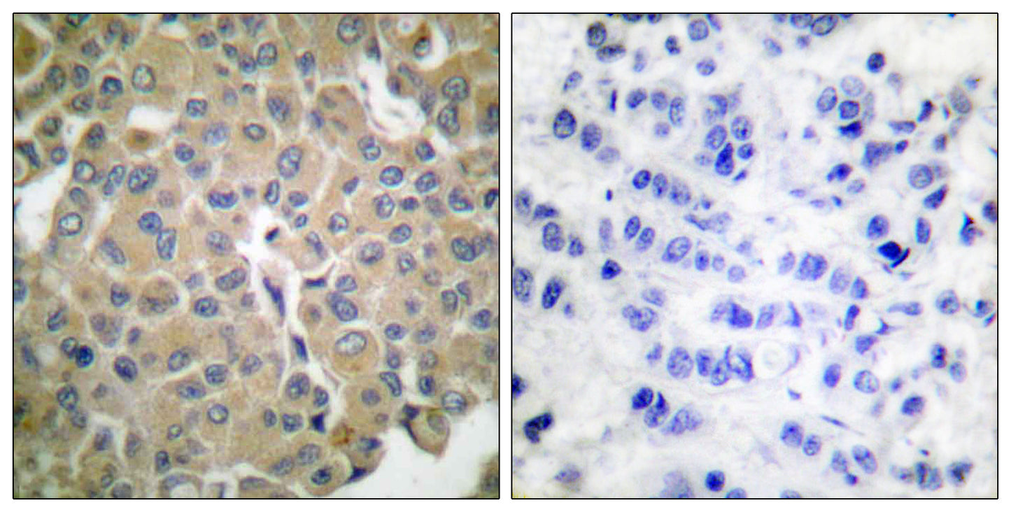 Melan-A Rabbit Polyclonal Antibody