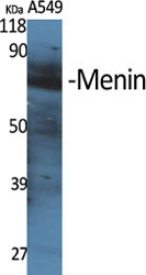 Menin Rabbit Polyclonal Antibody