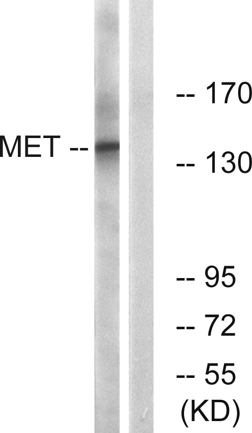 Met Rabbit Polyclonal Antibody