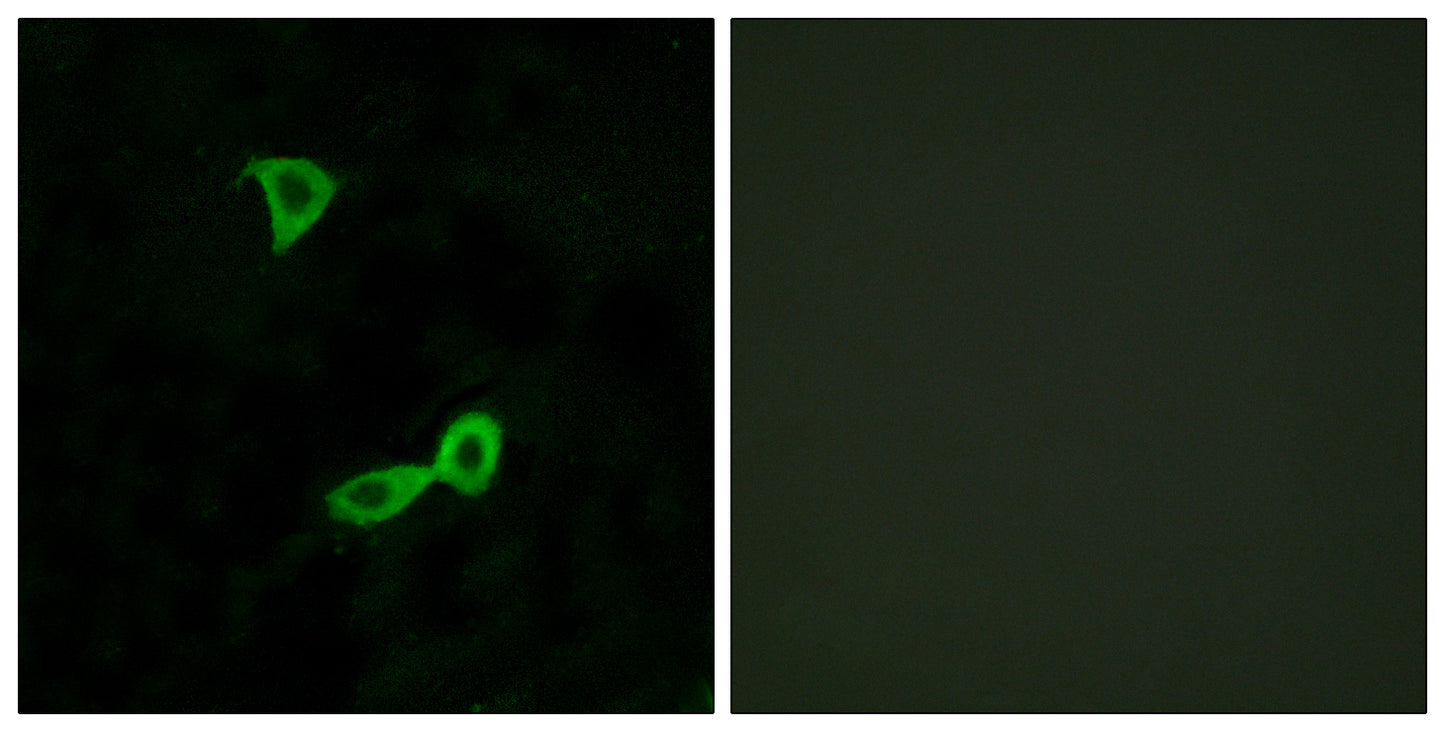 mGluR2 Rabbit Polyclonal Antibody