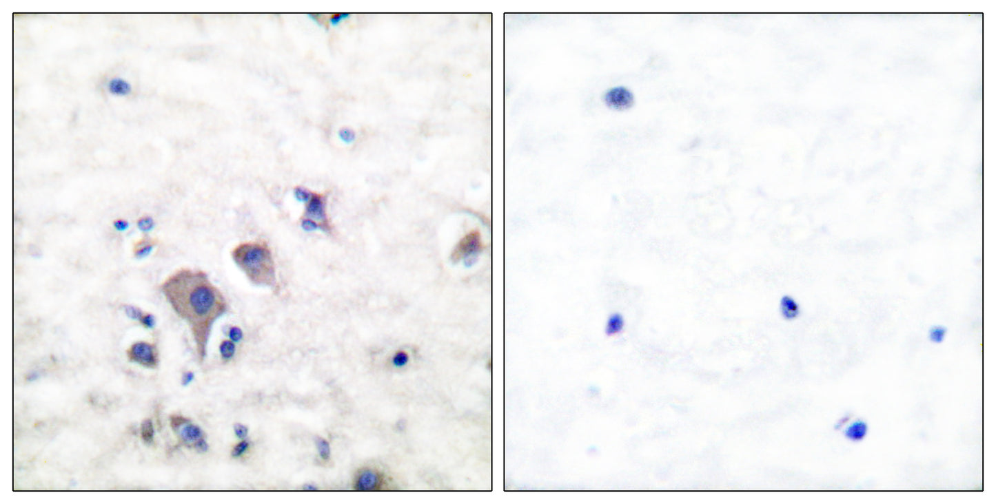 mGluR-2/3 Rabbit Polyclonal Antibody