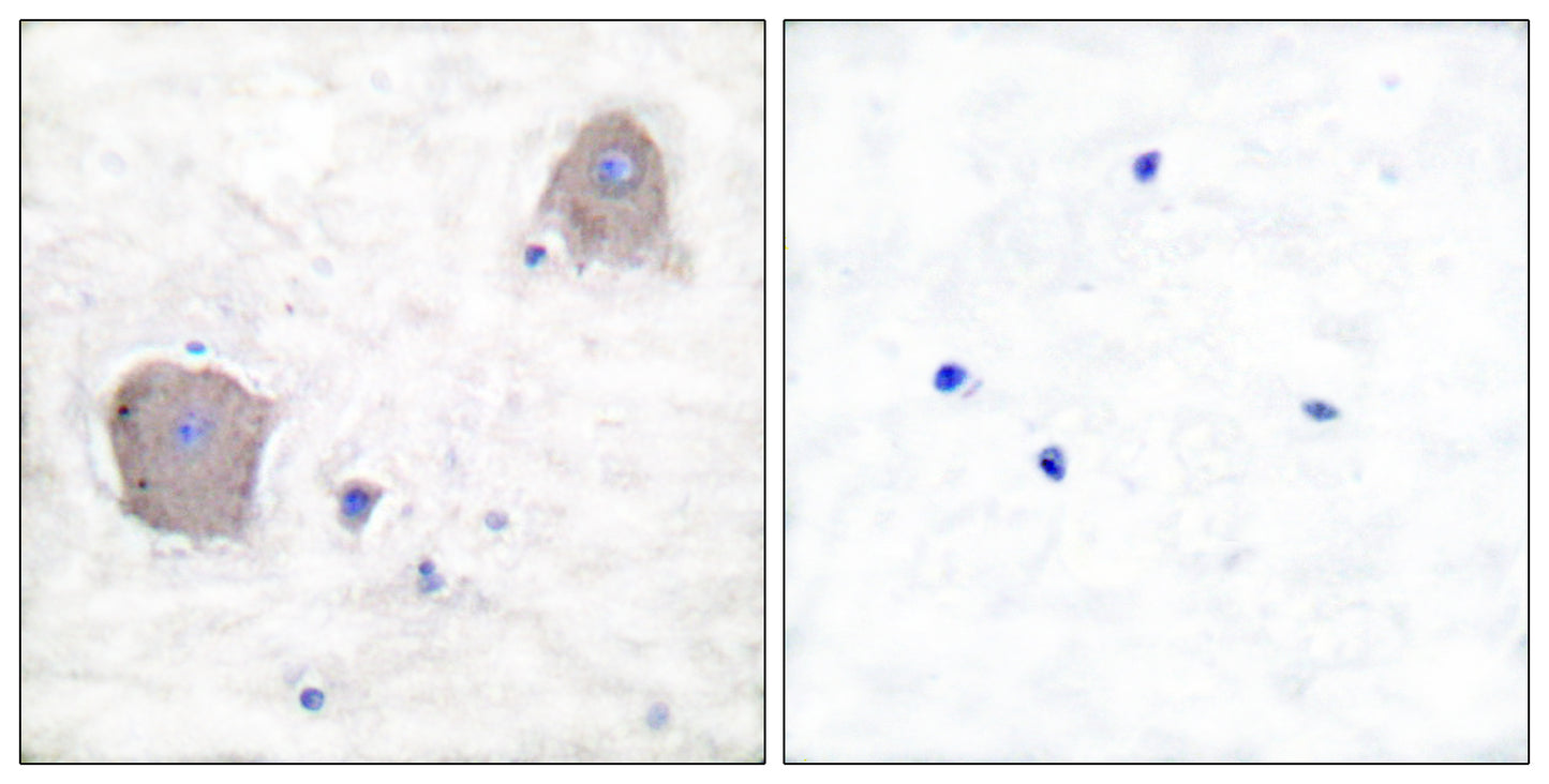 mGluR-4 Rabbit Polyclonal Antibody