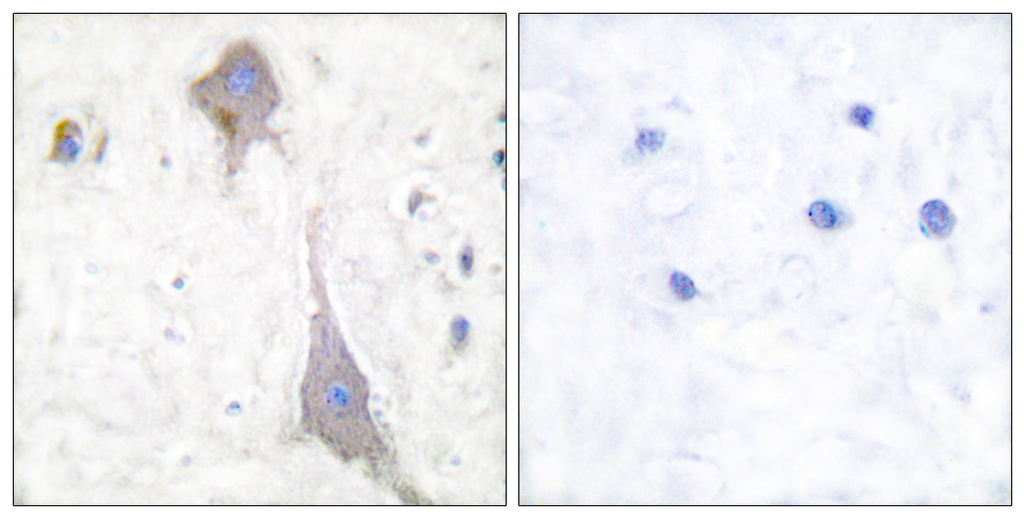mGluR-7 Rabbit Polyclonal Antibody