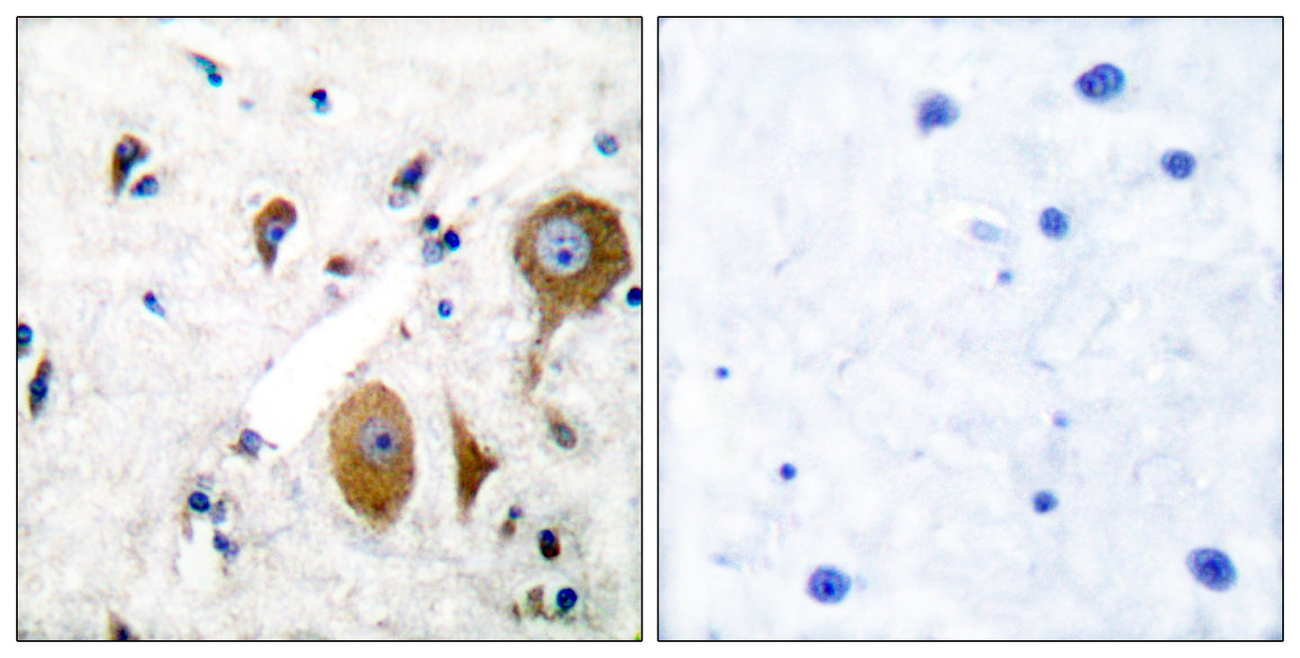 mGluR-8 Rabbit Polyclonal Antibody