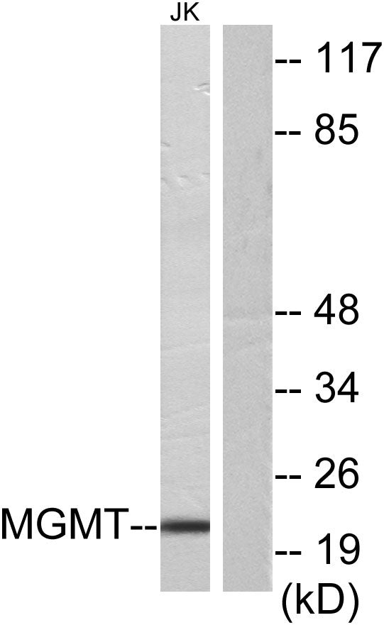 MGMT Rabbit Polyclonal Antibody
