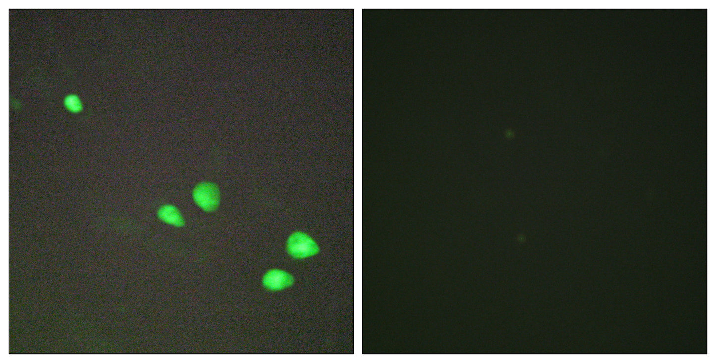 Mi2-β Rabbit Polyclonal Antibody