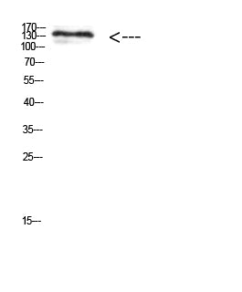 MIB1 Rabbit Polyclonal Antibody