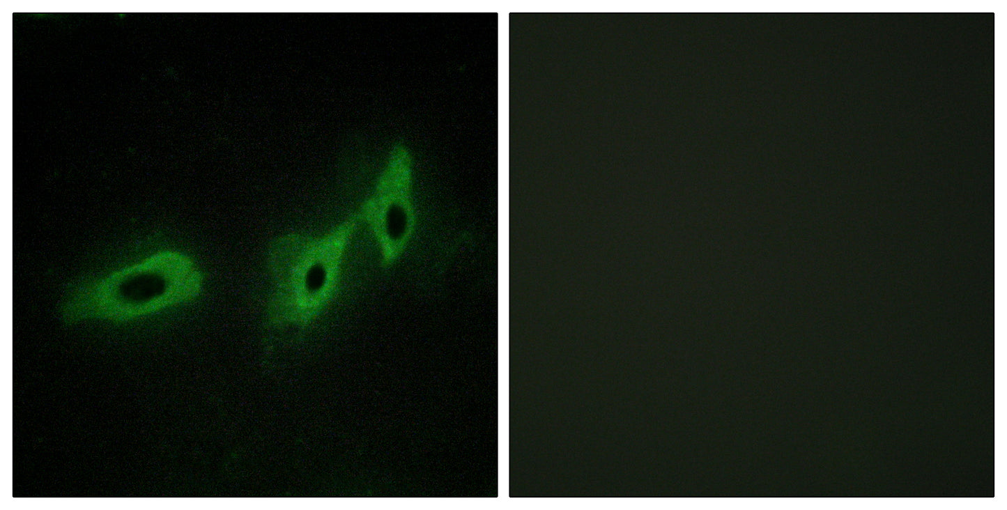 Midline-1 Rabbit Polyclonal Antibody