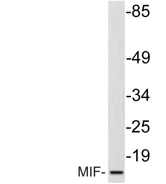 MIF Rabbit Polyclonal Antibody