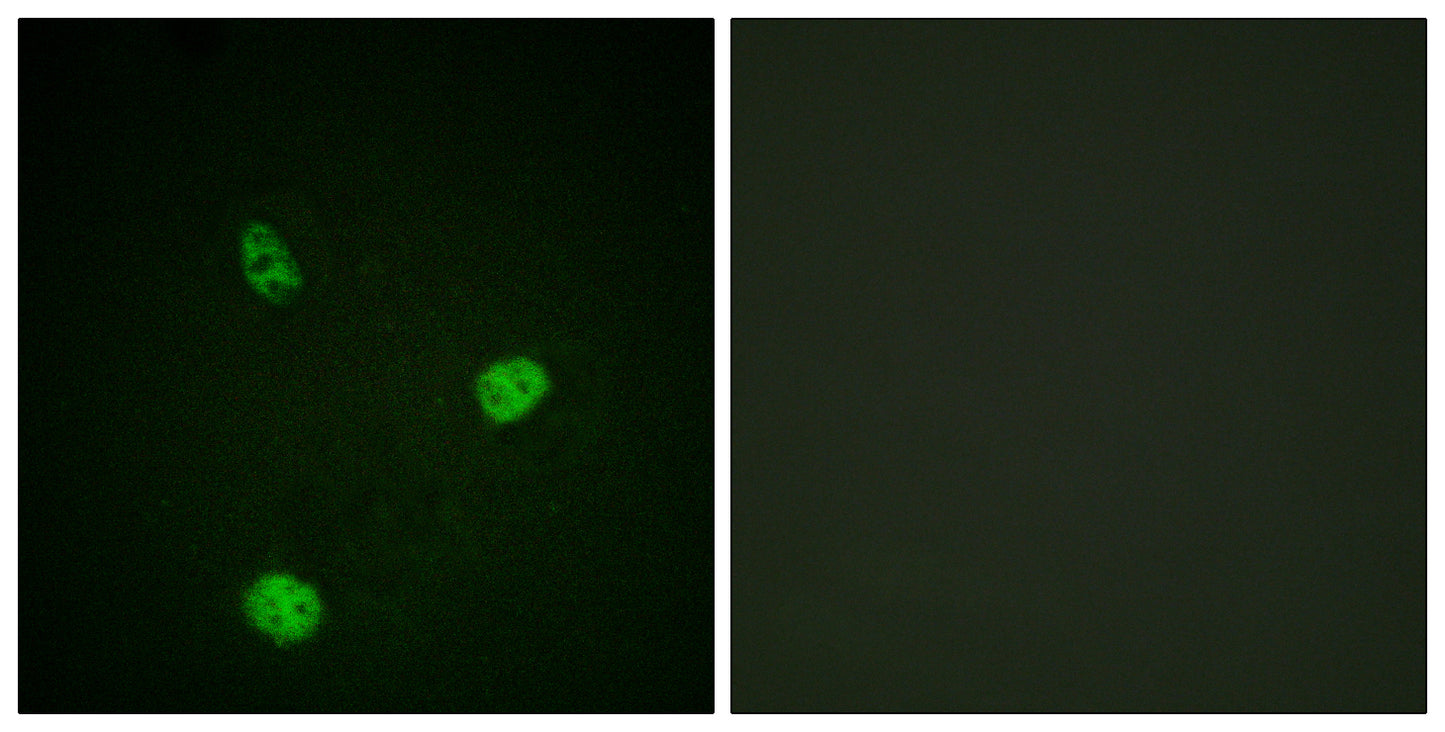 MITF Rabbit Polyclonal Antibody