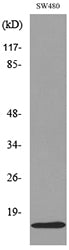 MK Rabbit Polyclonal Antibody