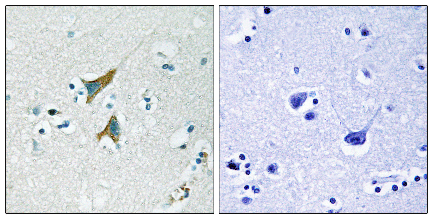 MKP-1 Rabbit Polyclonal Antibody